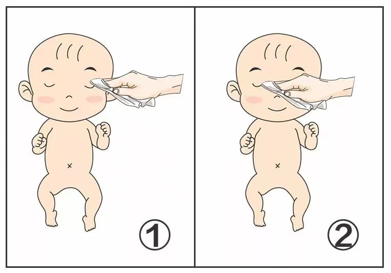 育兒百科|新生兒的眼睛十分嬌嫩，如何掌握眼部護(hù)理關(guān)鍵要點(diǎn)