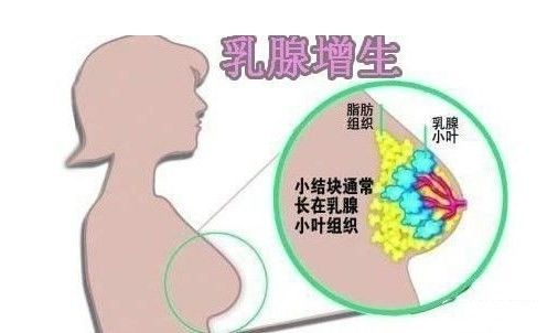 乳房出現(xiàn)“青筋”是什么原因呢？