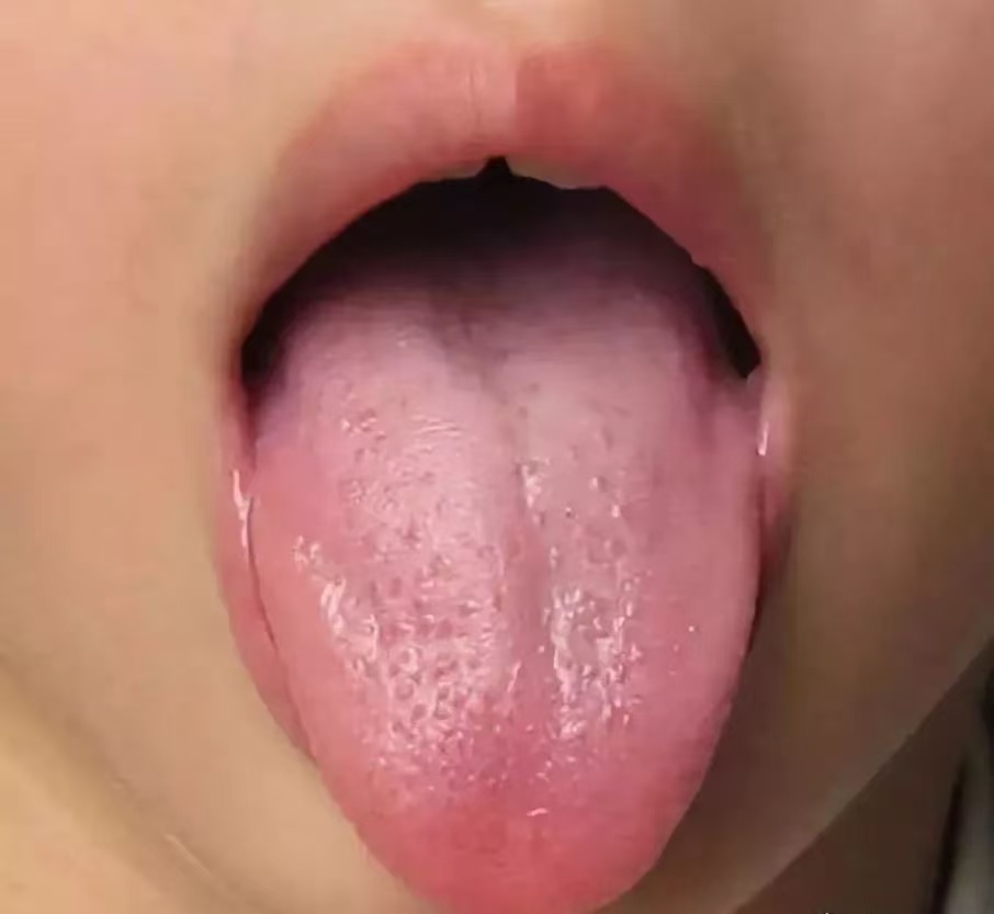 過(guò)度喂養(yǎng)危害大，寶寶發(fā)出的積食信號(hào)你能看懂多少？