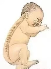 【母嬰知識】“頭”等大事，新生兒枕頭使用須知！