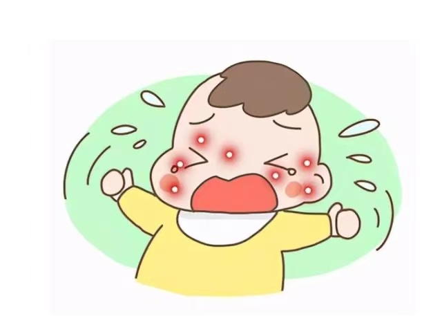 孩子濕疹反復(fù)發(fā)作怎么辦？這些防治方法請(qǐng)收好！